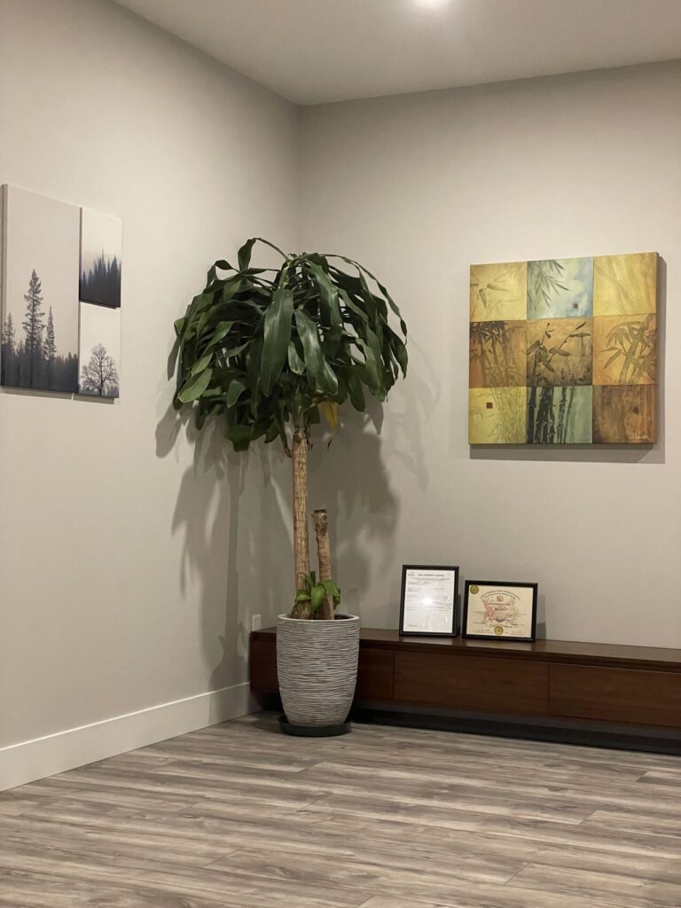 Acupuncture Kelowna